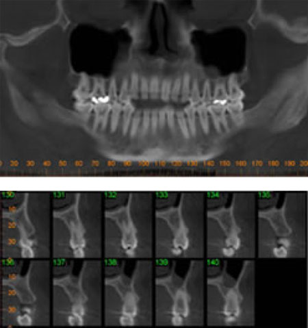 Perio PLLC - CT SCan